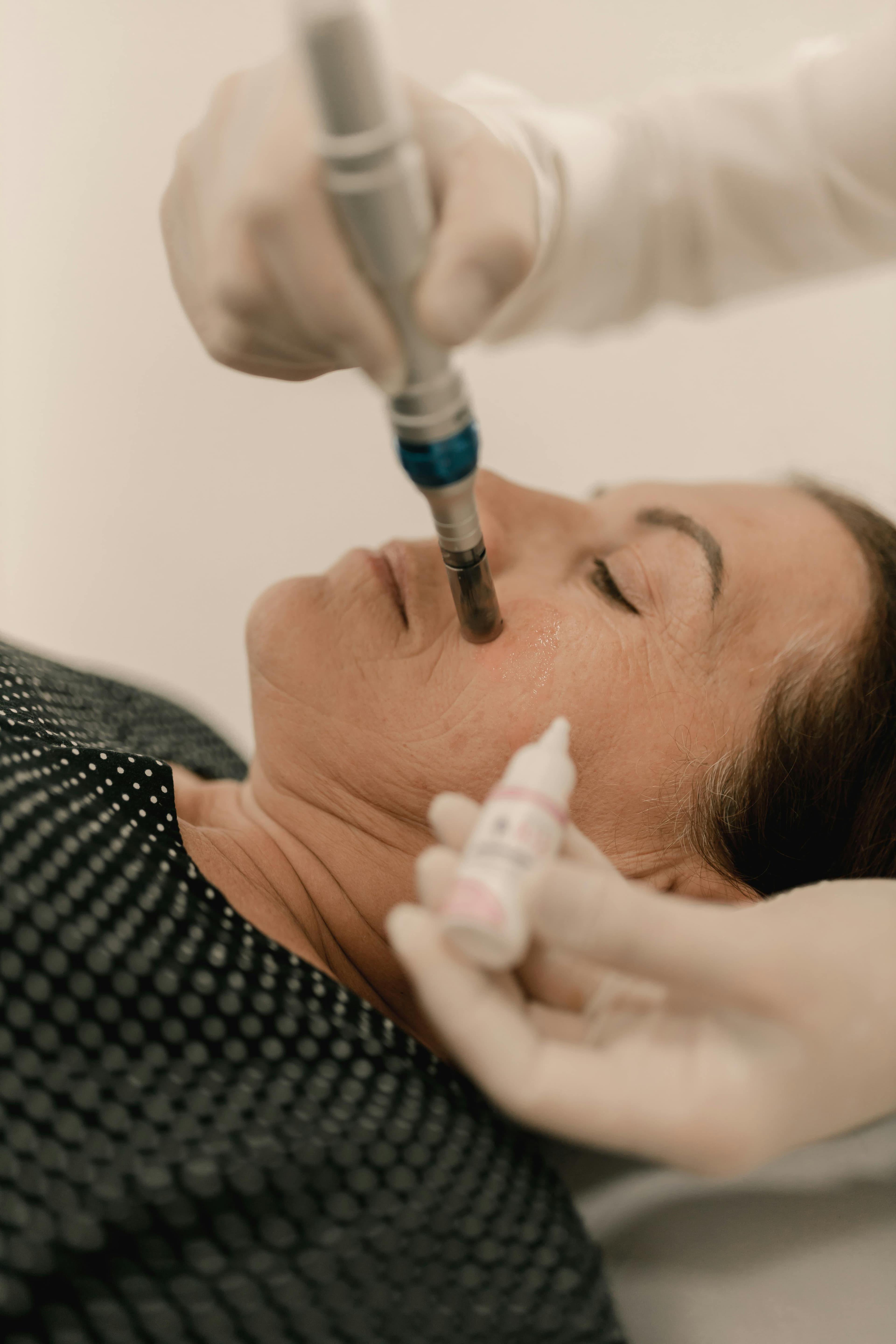 Microneedling
